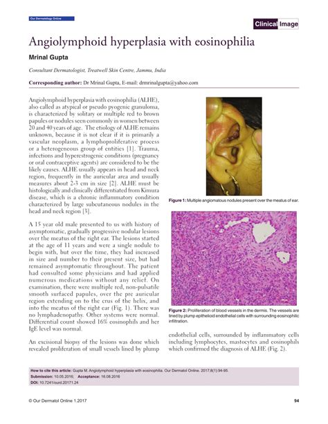 (PDF) Angiolymphoid hyperplasia with eosinophilia