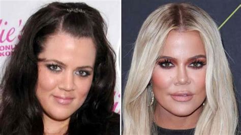 Kardashian-Jenner Sisters: Who Has Had The Most Plastic Surgery?