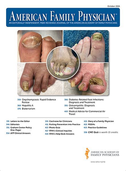 Onychomycosis: Rapid Evidence Review | AAFP