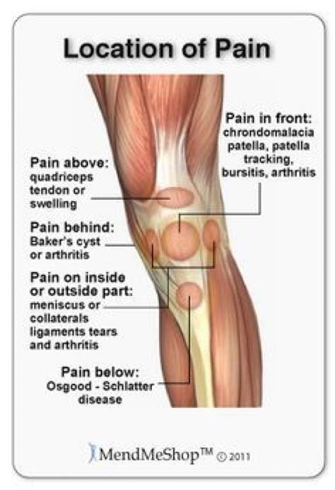 Pin on Joint Pain relief