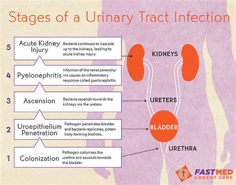 stages of UTI | Urinary tract infection, Urinary tract, Nursing notes