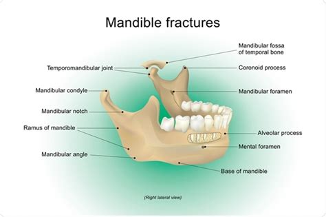 Angle Of Mandible