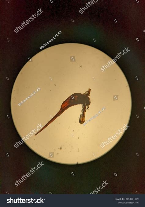 Photo Bee Sting Under Microscope Stock Photo 2153761969 | Shutterstock