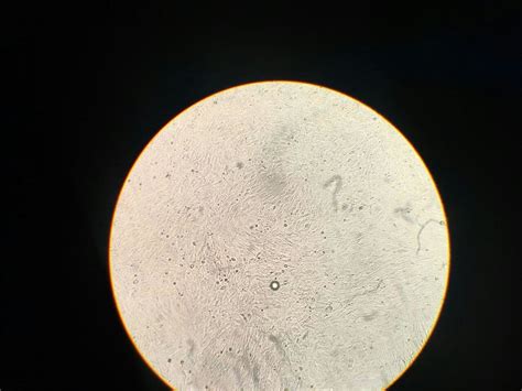 How can I identify and distinguish between cell culture contamination and cell debris?