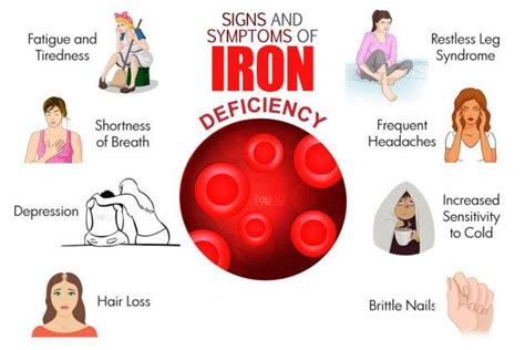 Iron deficiency anemia