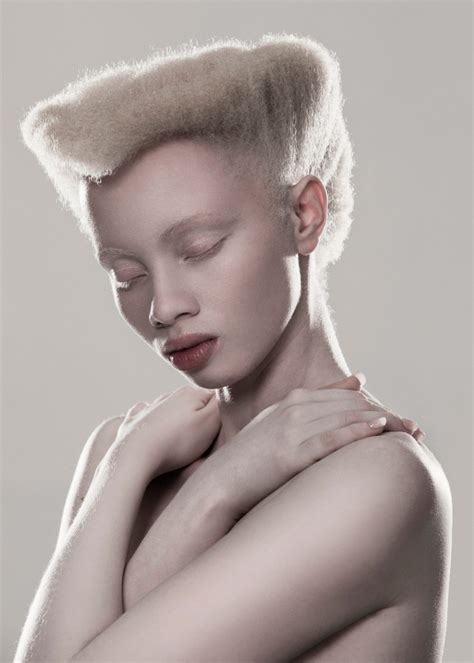 Shaun Ross y Thando Hopa: la realidad de los modelos africanos con albinismo - Viste la Calle