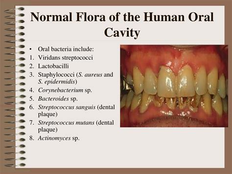 PPT - Normal Flora PowerPoint Presentation, free download - ID:4214563