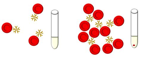 Rapid Gel Card Agglutination Assays For Serological, 45% OFF