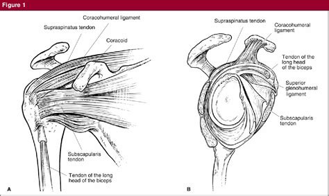 [PDF] The Rotator Interval: Anatomy, Pathology, and Strategies for Treatment | Semantic Scholar