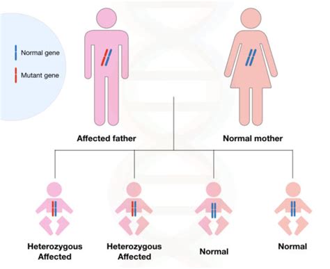 How is Huntington's Disease Inherited?