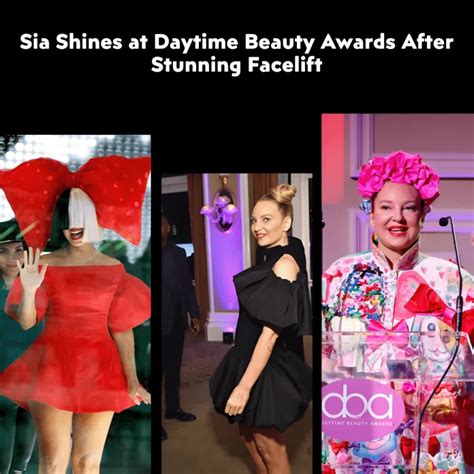 Sia's Facelift: Singer Looks Radiant at Daytime Beauty Awards