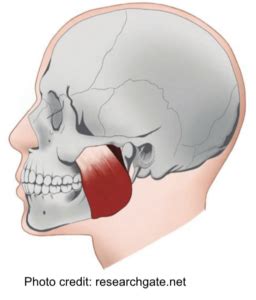 Masseter Muscle Hypertrophy: To Chew or Not To Chew?