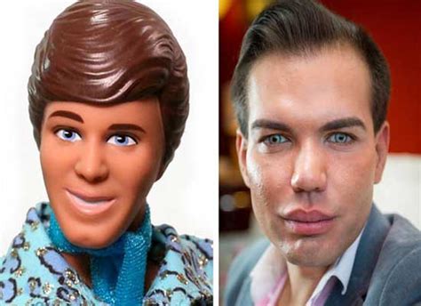 Plastic Surgery Ken Doll: Before and After Pictures - Plastic Surgery Facts