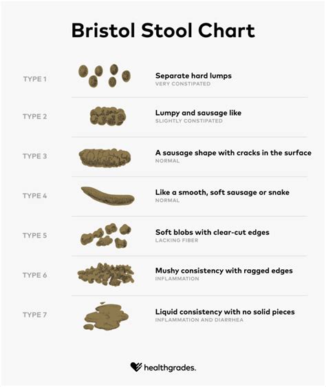 Ulcerative Colitis Poop: Stool Appearance, Treatment, and More