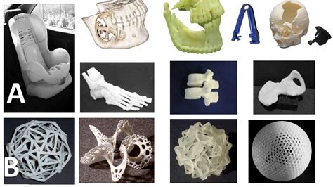 3D Printing and its Future in Medical World | Journal of Medical Research and Innovation