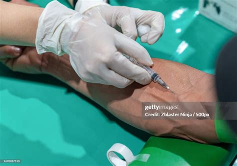 Close Up Needle Draw Blood On Arms Patient Thailand High-Res Stock Photo - Getty Images