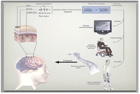 Brain Jack Image: Brain Computer Interface