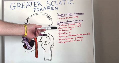 Suprapiriform Foramen