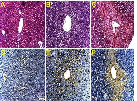 Peroxynitrite formation and sinusoidal endothelial cell injury during acetaminophen-induced ...