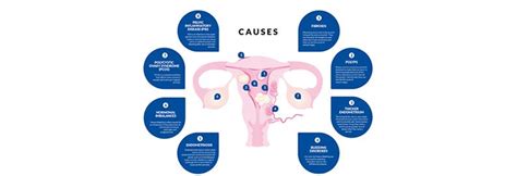 Infographic: Causes of heavy periods | Wear White Again