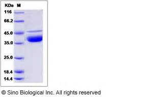 Recombinant Human DNase I Protein, 13801-H08H | Sino Biological