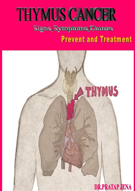 THYMUS CANCER Signs,Symptoms,Causes, Prevent and Treatment - Payhip