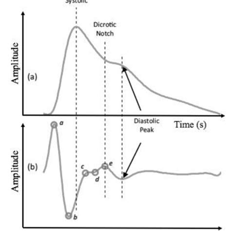 (PDF) Methods of Extracting Feature from Photoplethysmogram Waveform ...