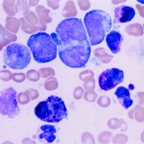 Comparison of the phenotype of normal human mast cells, basophils, and... | Download Table