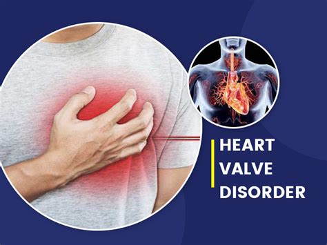 Types, Symptoms And Causes of Heart Valve Disease | OnlyMyHealth