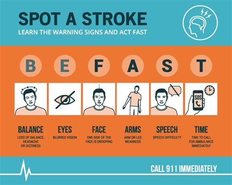 When it Comes to Stroke It's Important to Be FAST