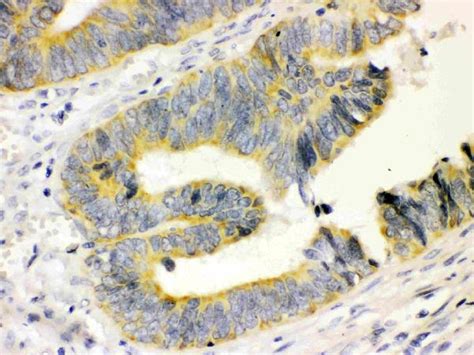 Calbindin-D Antibody (Monoclonal, CB-955)