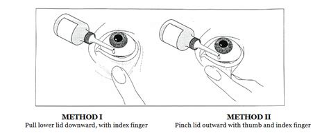 Tips For Administering Eye Drops