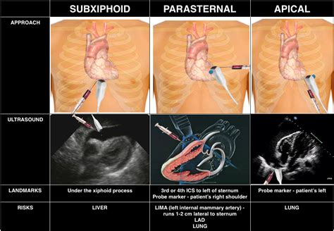 Episode 54 – The Pericardium | FOAMcast