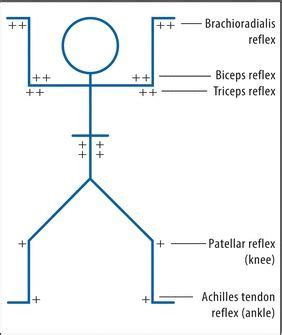 Deep Tendon Reflex Chart | Labb by AG