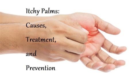 Itchy Palms: Causes, Treatment, and Prevention - LearningJoan