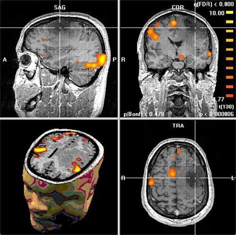 NEUROCIENCIA | LA "fMRI" - IMAGENES POR RESONANCIA MAGNETICA FUNDIONAL ...