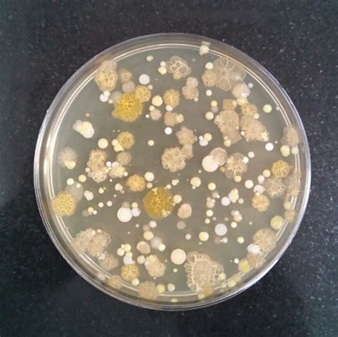 Microbiology Solutions: Selection of incubation conditions for environment monitoring plates in ...