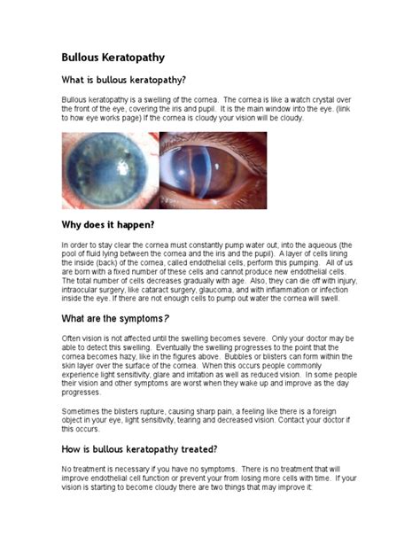 Bullous Keratopathy | PDF | Cornea | Human Eye