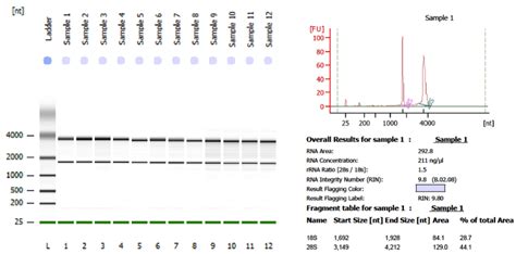 SYBR Green qPCR with Standard Curve Protocol