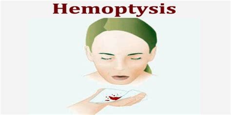 Hemoptysis - Assignment Point