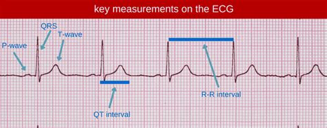 Why the QT interval matters - Straight A Nursing