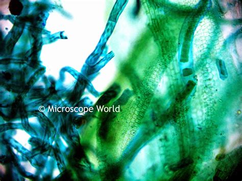 Microscope World Blog: Moss Under the Microscope