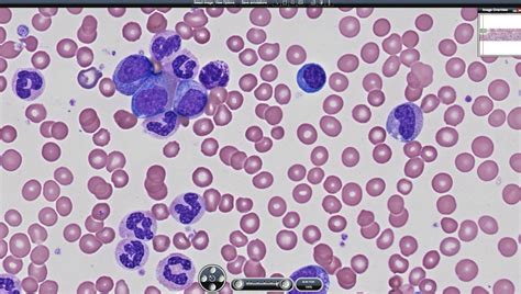 Plasmodium Microscope Slide