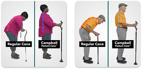 Campbell Posture Cane™ - The Ingenious Walking Cane That Allows You To Walk More Upright