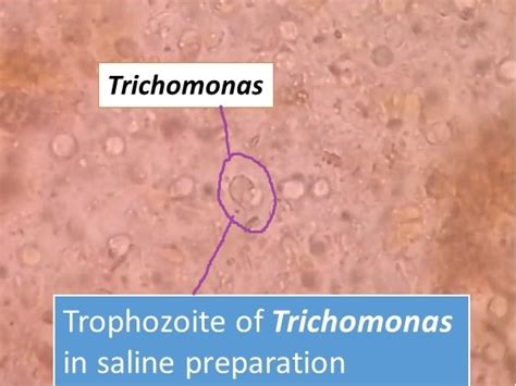 Trophozite of Trichomonas in stool : Introduction, Morphology and Laborato