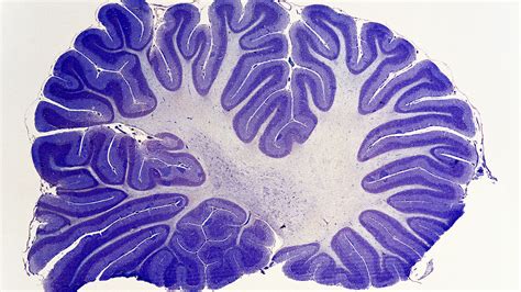 Cerebellum Plays Bigger Role In Human Thought Than Previously Suspected ...