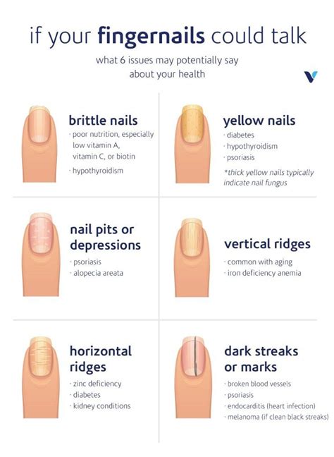 What Your Fingernails Say About Your Health | What's Good by V | Fingernail health, Nail health ...