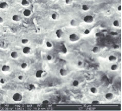 -Surface conditioned for 10 s (5000X). Many open dentin tubules,... | Download Scientific Diagram