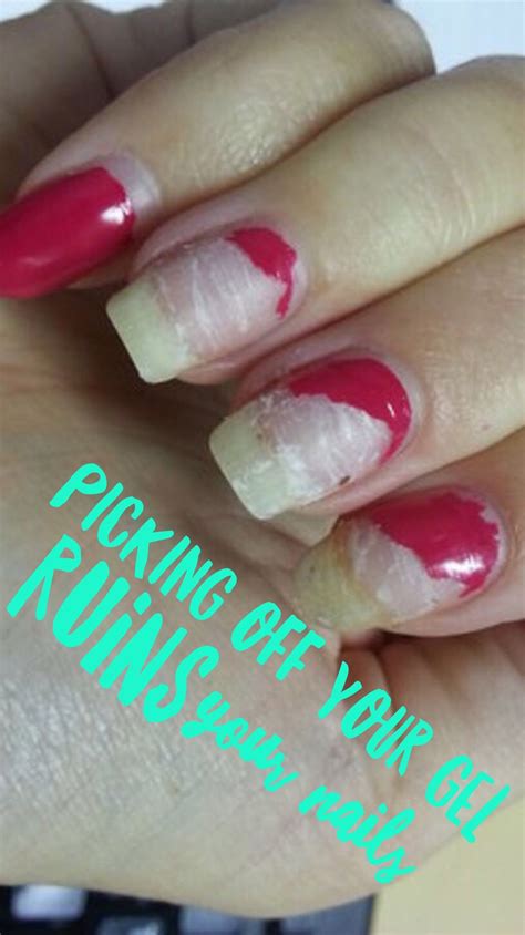 Picking off gel nail polish - If applied & removed correctly, gel causes no damage to the nail ...