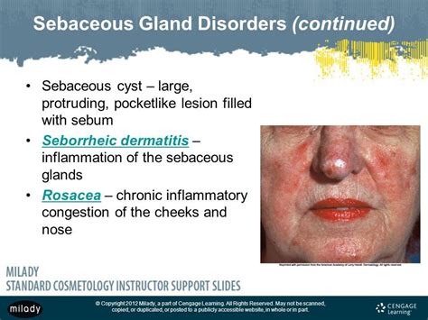 Sebaceous gland disorders Skin Disorders, Rosacea, Cosmetology, Cheek, Chronic, Disease, Nose ...